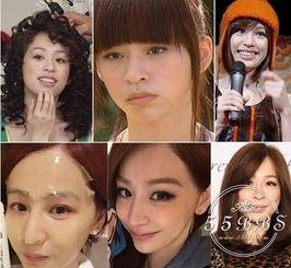 中国整容失败明星,美丽背后的代价与反思